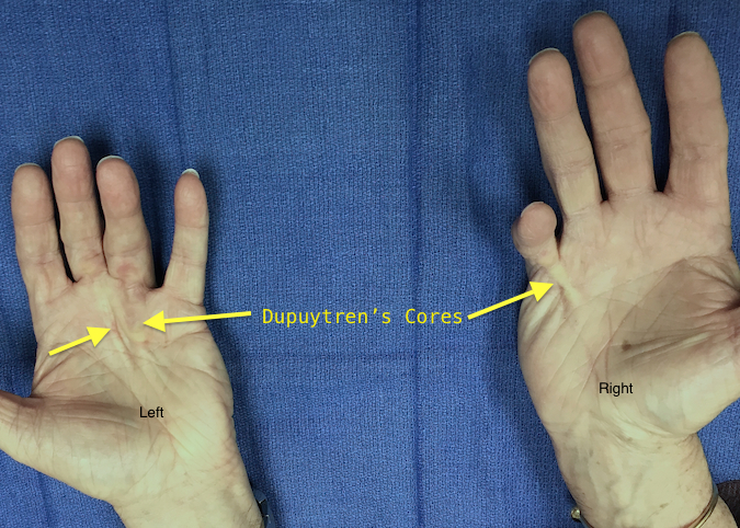 table-top-test-hand-surgery-source